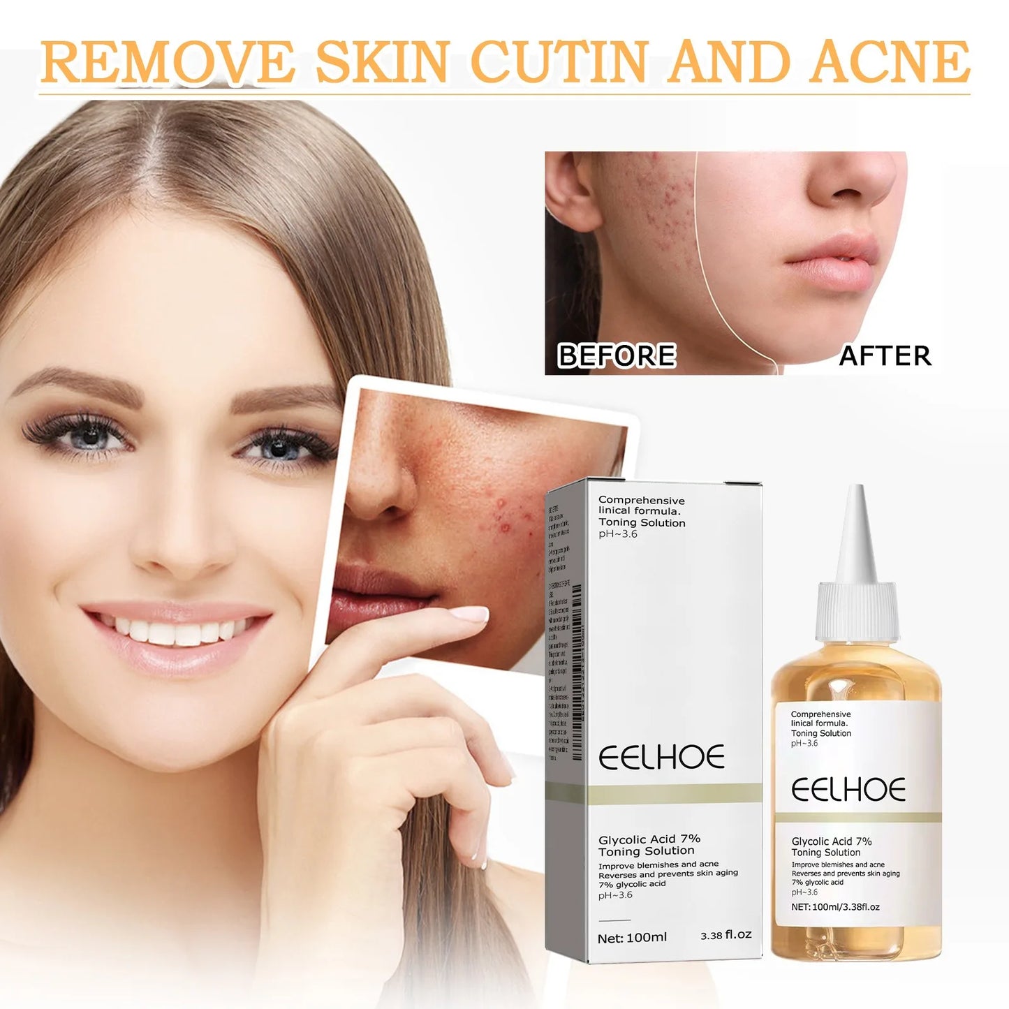 EELHOE Glycolic Acid 7% Toning Solution